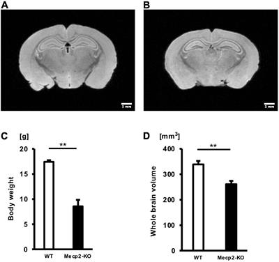 Comprehensive Volumetric Analysis of Mecp2-Null Mouse Model for Rett Syndrome by T2-Weighted 3D Magnetic Resonance Imaging